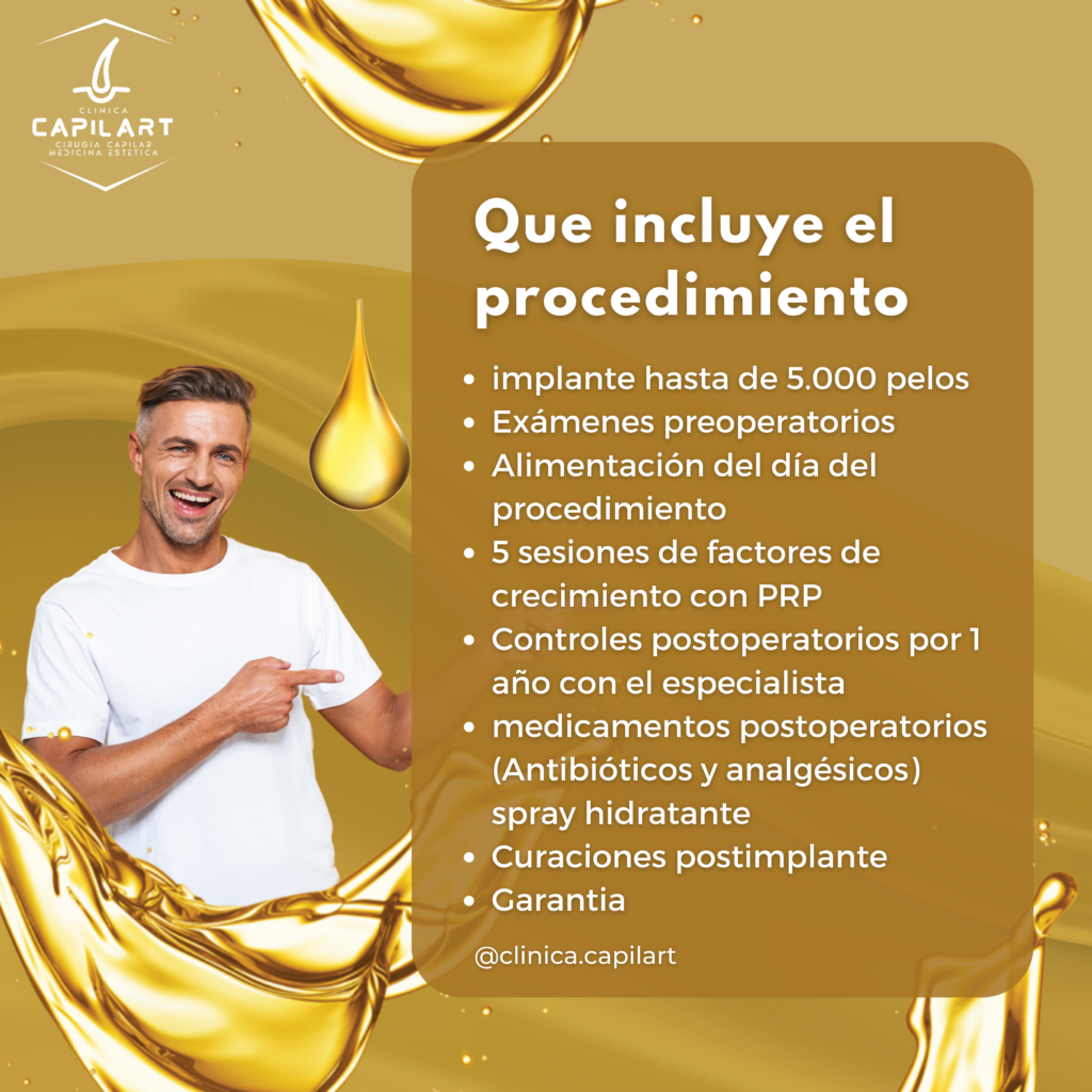 QUE INCLUYE EL IMPLANTE EN CLÍNICA CAPILART