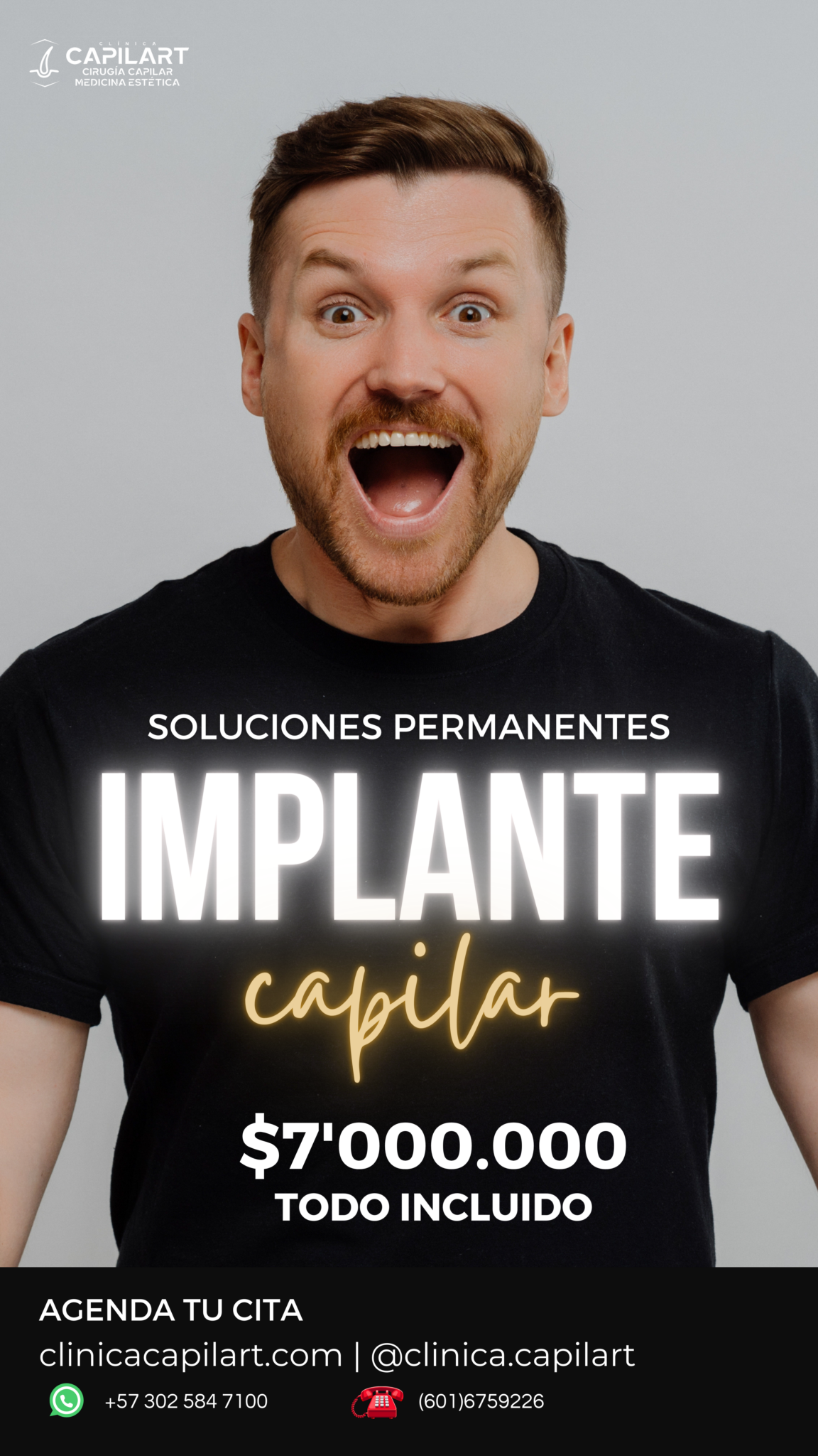 Implante capilar febrero 2024, Clínica CapilArt Bogotá